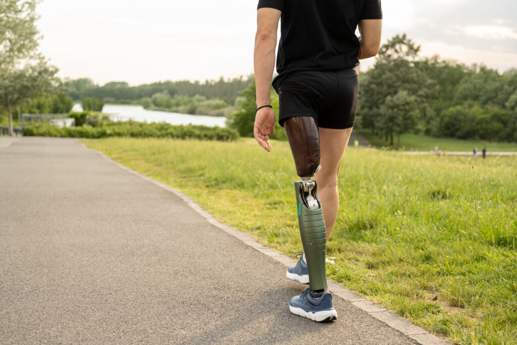 Życie z protezą - 5 kroków do pełnego komfortu i akceptacji